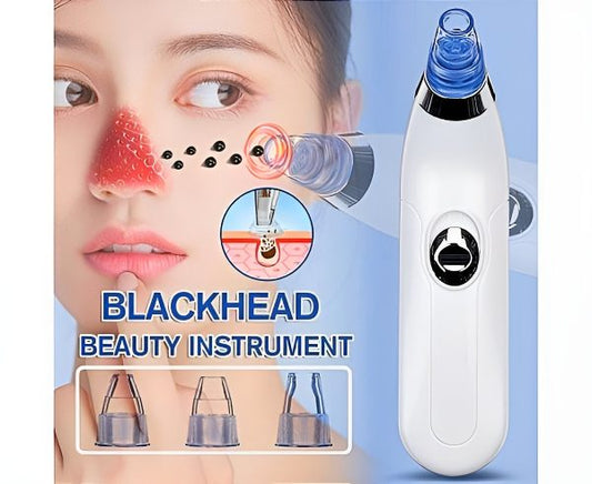 Blackheads Remover 3 In 1 Black Head Remover Machine-acne Pimple Pore Cleaner Vacuum Suction Tool (cell Operated)